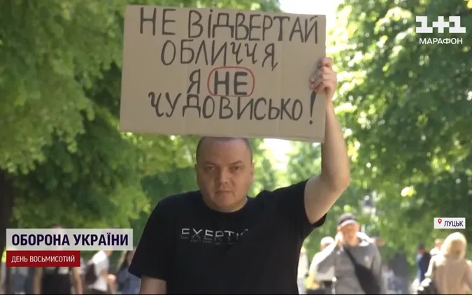 «Я не чудовисько»: у Луцьку військовий, який втратив ногу, влаштував акцію
