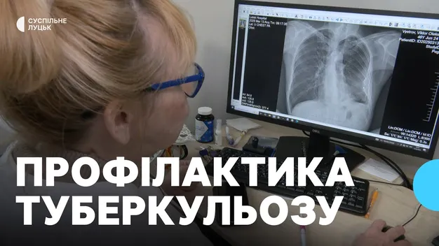 На Волині різко зросла кількість хворих на туберкульоз