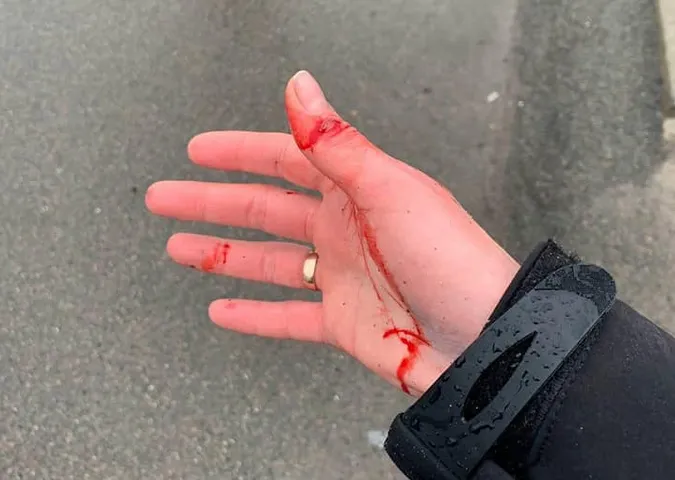 Зробила зауваження: у Луцьку підприємці напали на інспекторку з паркування (фото, відео)