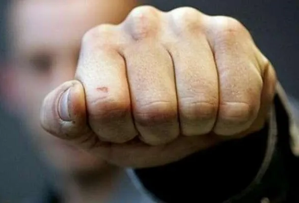 У Полтавській області охоронці нічного клубу побили прокурора