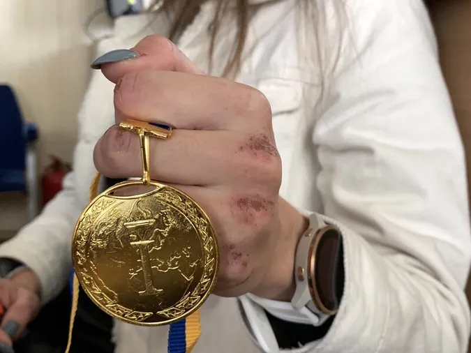 «Було доволі небезпечно»: волинські лижники про перемогу на чемпіонаті України (фото)