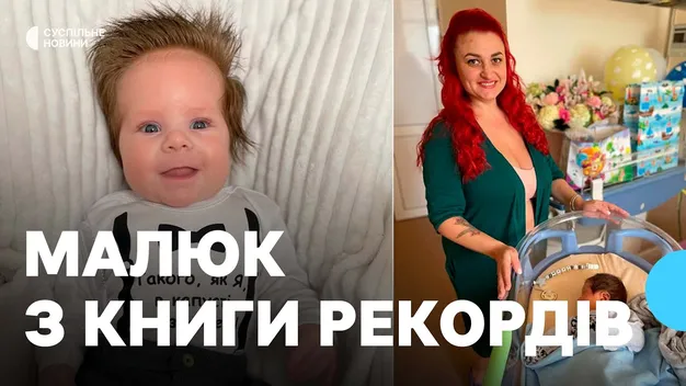 Малюк з Житомирщини народився з довжелезним волоссям (відео)