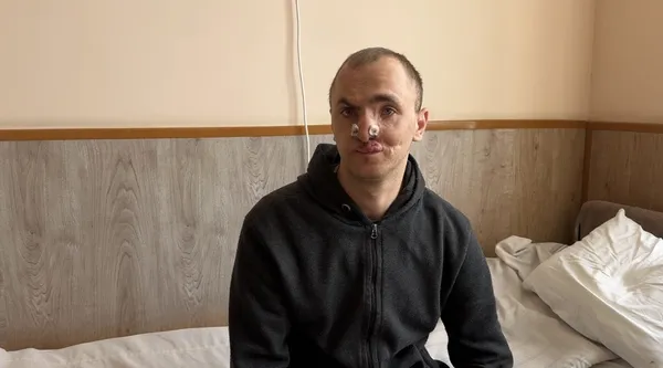 Відновлюють обличчя та руки: як канадські лікарі рятують поранених бійців у Луцьку (фото)
