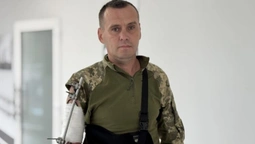 Кисть висіла, а пальці не рухались: як воїну з Волині рятують руку (фото)