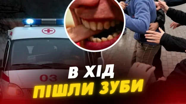 На Волині чоловік під час сварки відгриз палець супернику (відео)