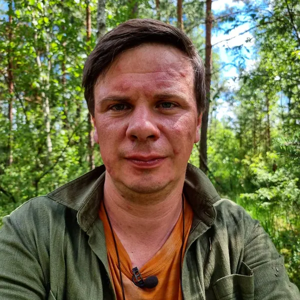 Дмитро Комаров показав, що з ним зробили волинські комарі (фото)