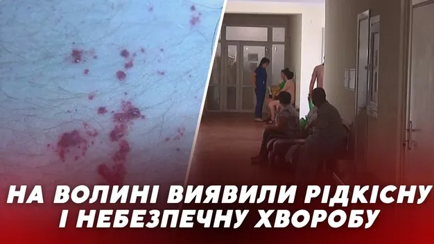 Хвороба Фабрі: на Волині виявили рідкісну і небезпечну хворобу (відео)