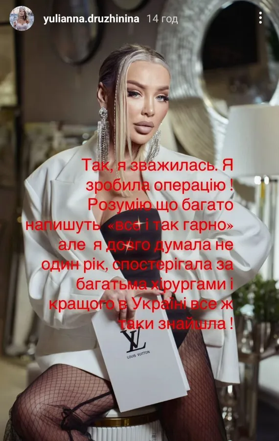 Тепер з носиком Барбі: луцька бізнеследі Дружиніна похизувалась пластикою обличчя (фото)