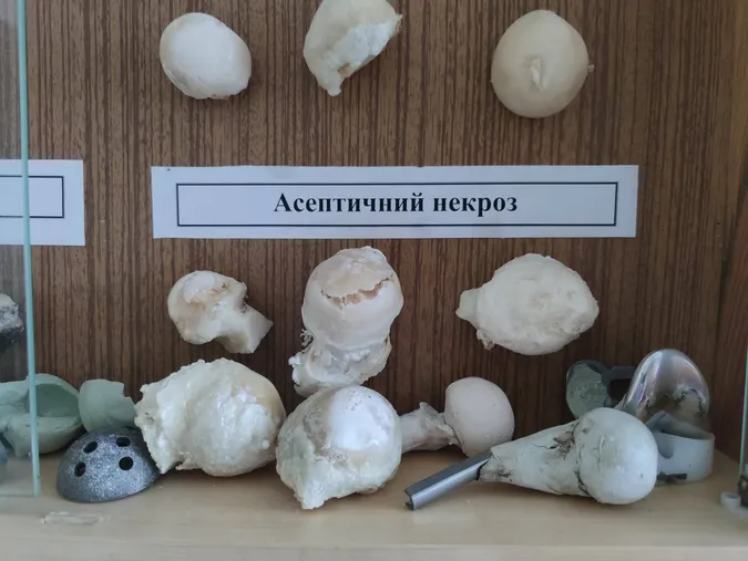 У Волинському військовому госпіталі зробили інноваційну операцію (фото)