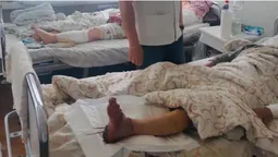 У луцькій лікарні вперше пришили жінці відрізану ногу (фото 18+)