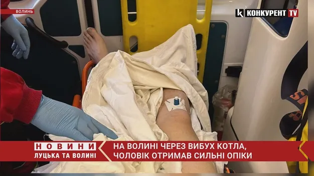 На Волині вибухнув котел – у чоловіка опіки 63% тіла (фото, відео)