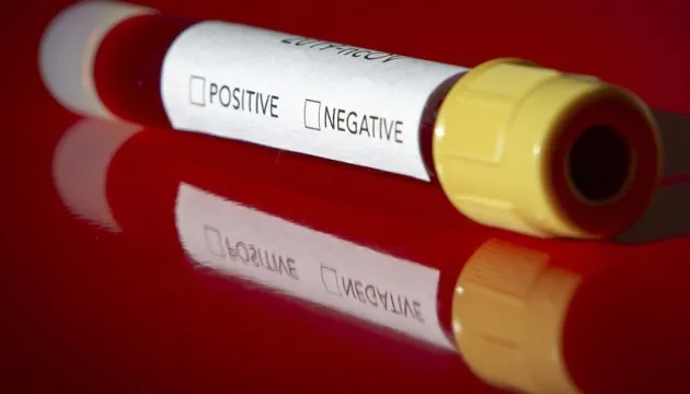 ВООЗ вважає, що пандемія коронавірусу триватиме довго