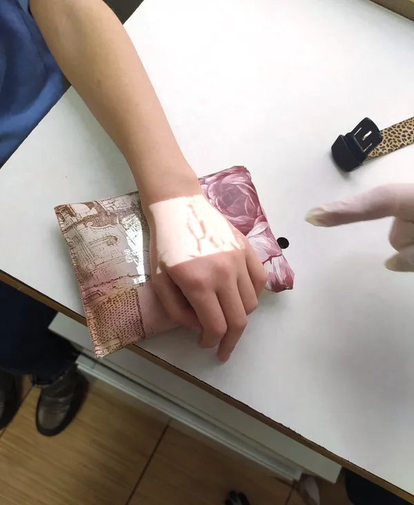 У дитячій поліклініці Луцька з’явився венозний сканер (фото)