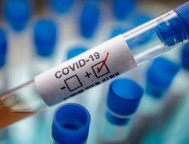На птахофабриці у Володимирі на COVID-19 захворіли 48 працівників