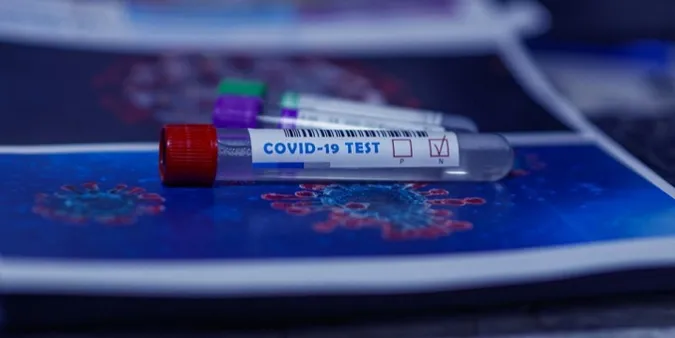 Рейтинг загальної кількості заражень COVID: Україна – на восьмому місці