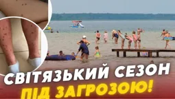 На Світязі нова хвиля скарг на висип після купання: воду досліджує екоінспекція (відео)