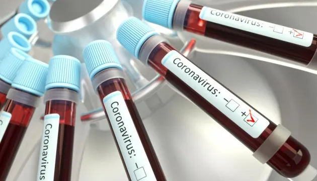 Кількість хворих на COVID-19 в Україні сягнула 418