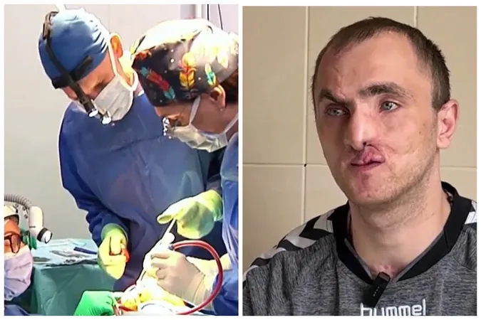 «Не було ні носа, ні щелепи»: у Луцьку канадські лікарі повернули обличчя пораненому бійцю (відео)