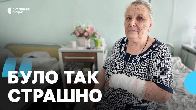 «Осколками засипало лице, рука юшила»: 86-річна лучанка розповіла, як потрапила у лікарню після атаки рф (відео)