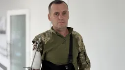 Кисть висіла, а пальці не рухались: як воїну з Волині рятують руку (фото)