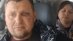На Волині ветеран звернувся до поліції через побиття працівниками ТЦК (відео)