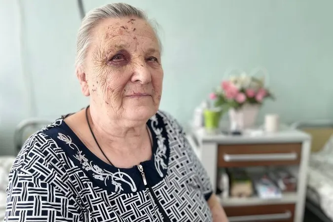 «Осколками засипало лице, рука юшила»: 86-річна лучанка розповіла, як потрапила у лікарню після атаки рф (відео)