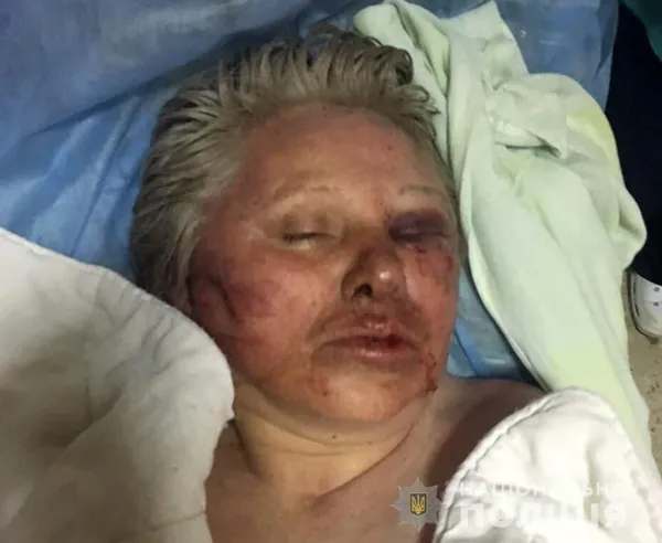 Жінка, яку знайшли на березі Стиру, досі без свідомості