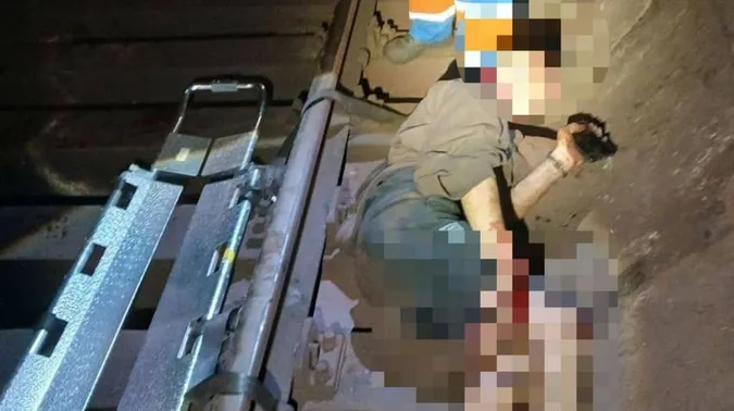 У Києві юнак впав на колію та сильно травмувався, бо хотів вразити підписників