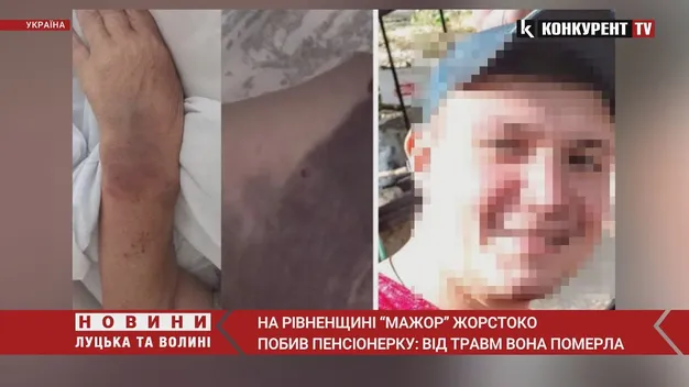Син директора Рівненської АЕС побив жінку похилого віку, – ЗМІ (відео)