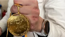 «Було доволі небезпечно»: волинські лижники про перемогу на чемпіонаті України (фото)
